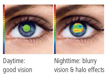 zeiss-iscription-low-vision-benefits