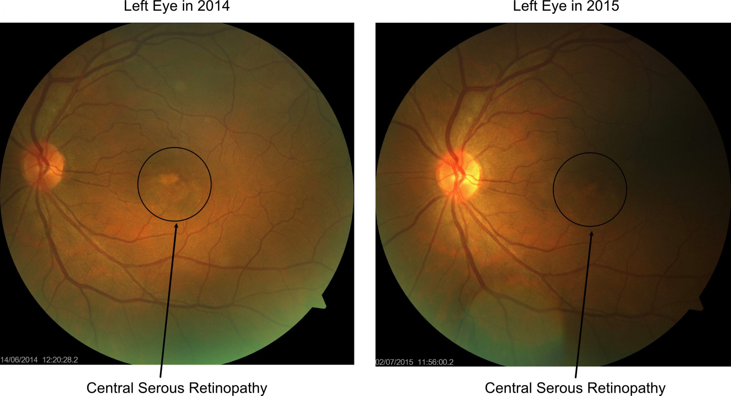 Eye Check FP - CSR