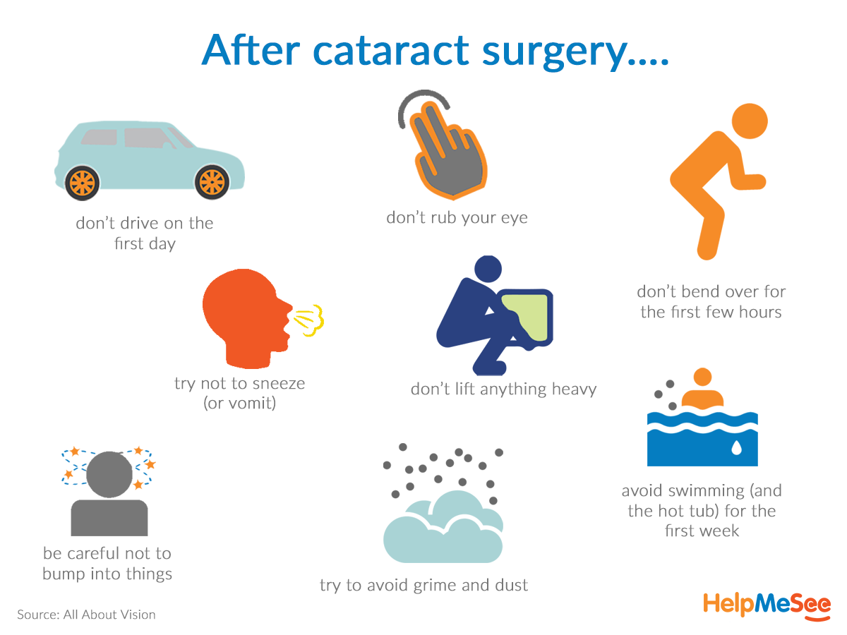 about-your-cataract-surgery-lyons-eye-care