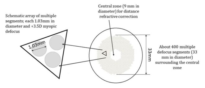 myopia control lens hoya miyosmart